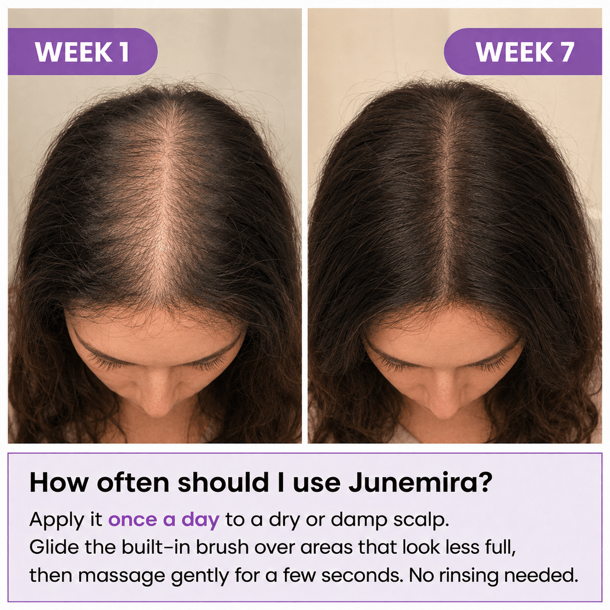 Junemira - Hair Growth Serum