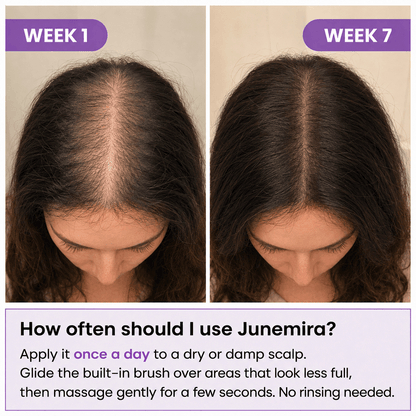 Junemira - Hair Growth Serum