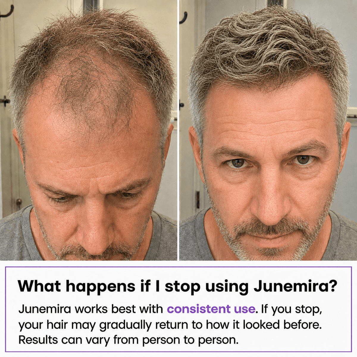 Junemira - Hair Growth Serum