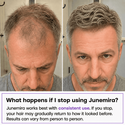 Junemira - Hair Growth Serum
